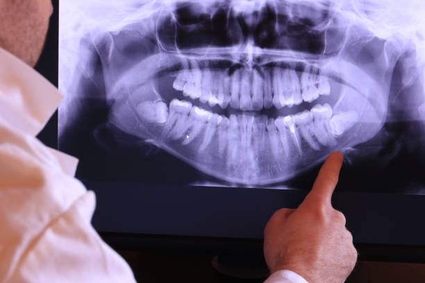 Best Emergency Gum Pain Relief  in Palestine, IL