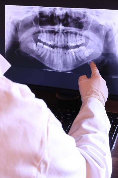 Best Dentist for Tooth Abscess  in Palestine, IL