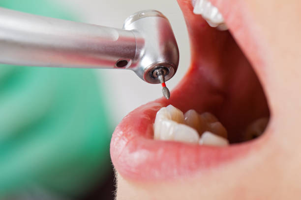 Best Tooth Pain Emergency Relief  in Palestine, IL